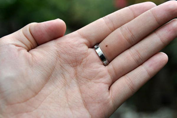 Khám phá ý nghĩa đặc biệt của các nốt ruồi trên ngón tay 