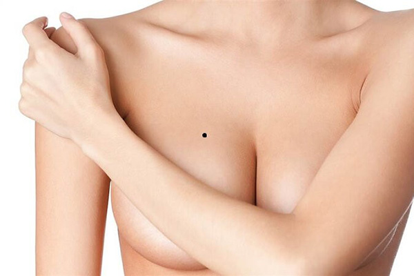 Nốt ruồi ở ngực phụ nữ - Là vận may hay vận hạn?
